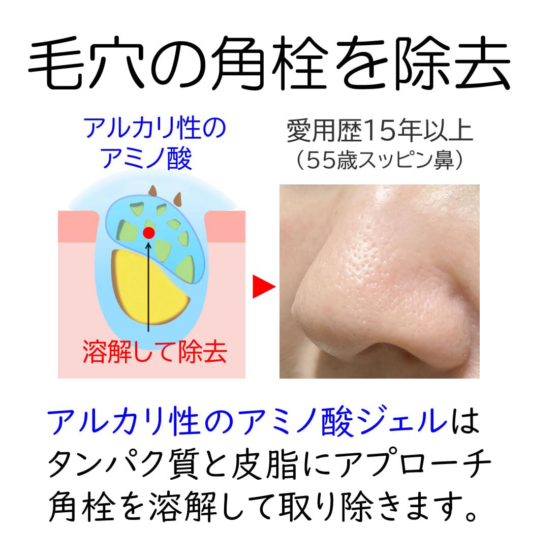 Amazon | SILK 酒さ 赤ら顔 クレンジング 水溶性ジェル 界面活性剤不